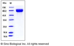Sino Biological Human SLC3A2 / CD98 Protein (His Tag) 1mg, Quantity: Each