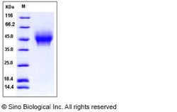 Sino Biological Human CD44 Protein (His Tag) 100ug, Quantity: Each of 1