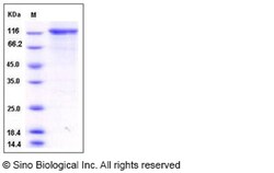 Sino Biological Human TLK1 / PKU-beta Protein (His & GST Tag) 50ug, Quantity: