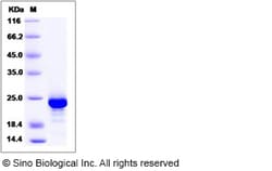 Sino Biological Human IL11 / Interleukin 11 / IL-11 Protein 1mg, Quantity: