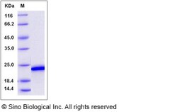 Sino Biological Human FGF19 Protein 50ug, Quantity: Each of 1