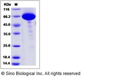 Sino Biological Recombinant Human COL9A1 Protein (mFc Tag), Quantity: Each
