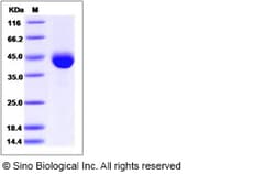 Sino Biological Recombinant Human COL9A1 Protein (His Tag), Quantity: Each