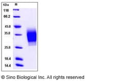 Sino Biological Recombinant Human TH1R/PTHR1 Protein (His Tag), HPLC-verified,