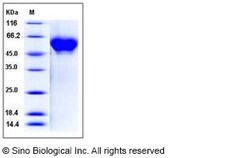 Sino Biological Human CD46 Protein (His Tag) 50ug, Quantity: Each of 1