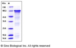 Sino Biological Human HSF1 / HSTF1 Protein (His Tag) 100ug, Quantity: Each