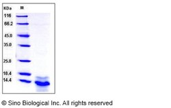 Sino Biological Human S100A14 / S114 Protein (His Tag) 50ug, Quantity: