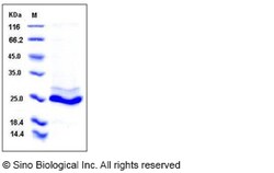 Sino Biological Human KRAS / K-Ras (Q61H) Protein (His Tag) 50ug, Quantity: