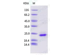 Sino Biological Recombinant Human KRAS Protein (His Tag), HPLC-verified