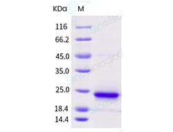 Sino Biological Recombinant Human KRAS Protein (His Tag) 500, Quantity: