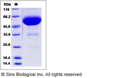 Sino Biological Recombinant Human CD47 Protein (ECD, hFc Tag), HPLC-verified,