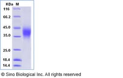 Sino Biological Recombinant Human CD47 Protein (ECD, His Tag), HPLC-verified,