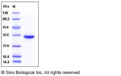 Sino Biological Recombinant Human Carbonic Anhydrase VB Protein (His Tag),