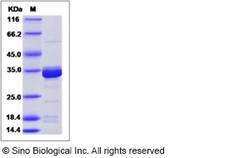 Sino Biological Human B3GAT3 / GLCATI Protein (His Tag) 20ug, Quantity: