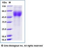 Sino Biological Human MICA Protein (His Tag) 100ug, Quantity: Each of 1