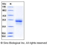 Sino Biological Recombinant Human IL-29/IFN-lambda 1 Protein (His Tag),