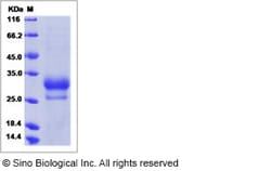 Sino Biological Recombinant Human IL-29/IFN-lambda 1 Protein, Quantity: