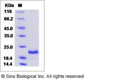 Sino Biological Recombinant Human IL-28A/Interferon lambda-2 Protein (His