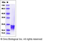 Sino Biological Recombinant Human FGF-17 Protein, Quantity: Each of 1