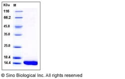 Sino Biological Recombinant Human L-FABP Protein (His Tag), Quantity: Each