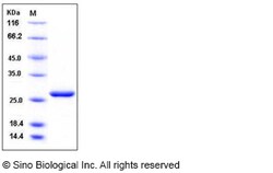 Sino Biological Recombinant Human LYPLA2 Protein (His Tag), Quantity: Each