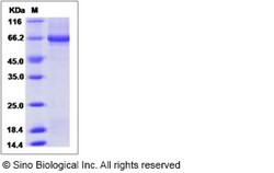 Sino Biological Recombinant Human Alkaline Phosphatase/PLAP/ALPP Protein