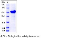Sino Biological Recombinant Human AK3L1 Protein (His & GST Tag), Quantity: