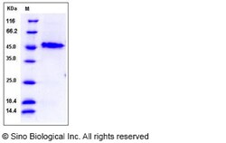Sino Biological Recombinant Human GAP-43 Protein (His Tag), Quantity: Each