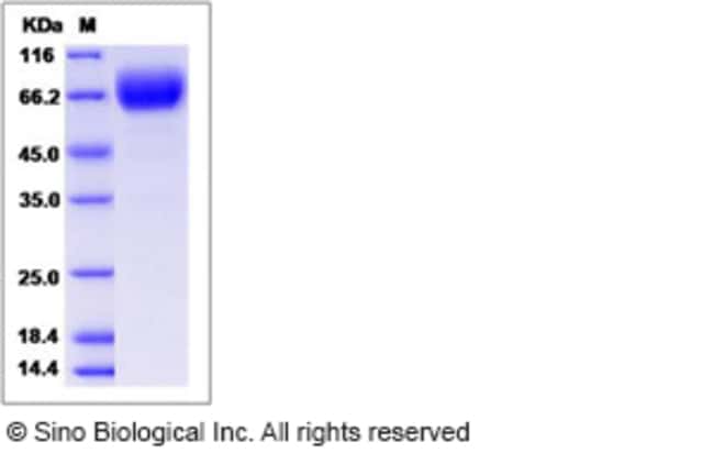 Sino Biological Human LFA-3 / CD58 Protein (Fc Tag) 1mg, Quantity: Each ...