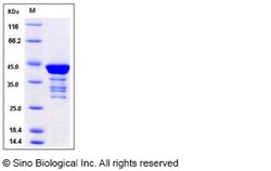 Sino Biological Recombinant Human C1D Protein (GST Tag), Quantity: Each