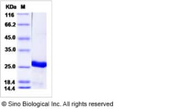 Sino Biological Recombinant Human UBE2T Protein (His Tag), HPLC-verified,