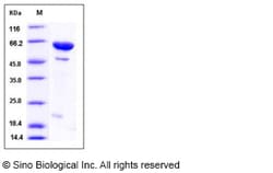 Sino Biological Human DUSP14 / MKP-6 Protein (His & MBP Tag) 100ug, Quantity: