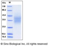 Sino Biological Recombinant Human CD300A/LMIR1 Protein (His Tag), Quantity: