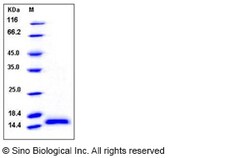 Sino Biological Recombinant Human PHPT1 Protein (His Tag), HPLC-verified,