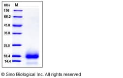 Sino Biological Human CD59 Protein (His Tag) 100ug, Quantity: Each of 1