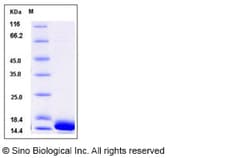 Sino Biological Recombinant Human CALML3 Protein (His Tag), Quantity: Each