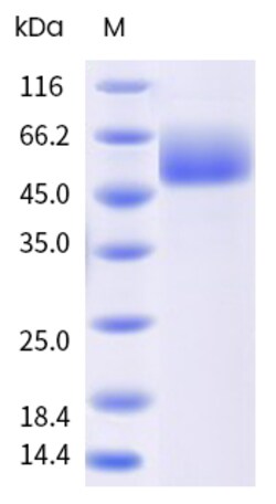 Sino Biological&nbsp;Recombinant Human KLRG1 Protein (ECD, hFc Tag) 100