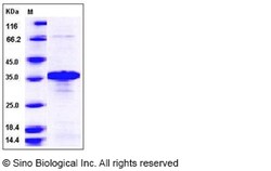 Sino Biological Human BNIP3L Protein 100ug, Quantity: Each of 1