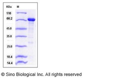 Sino Biological Recombinant Human Rack1 Protein (His & MBP Tag), HPLC-verified,