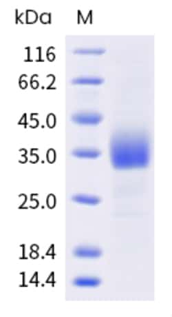 Sino Biological Human CD72 Protein 100ug (Sino Biological), Quantity: Each