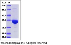 Sino Biological Recombinant Human BVES Protein (GST Tag), Quantity: Each