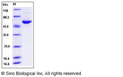 Sino Biological Human ALDH3A1 Protein (His Tag) 50ug, Quantity: Each of