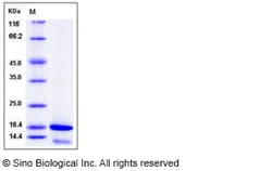 Sino Biological Human CDK2AP2 Protein (His Tag) 100ug, Quantity: Each of