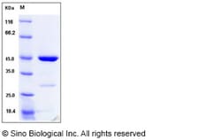 Sino Biological Recombinant Human p19 INK4d Protein (GST Tag), Quantity: