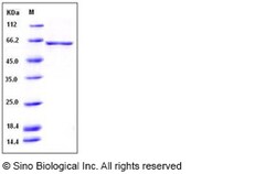 Sino Biological Recombinant Human GAD67 Protein (His Tag), Quantity: Each