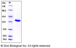 Sino Biological Human ACYP1 / Acylphosphatase-1 Protein (GST Tag) 100ug,