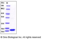 Sino Biological Recombinant Human FABP5 Protein, Quantity: Each of 1