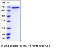 Sino Biological Recombinant Human C1qR1/CD93 Protein (His Tag), HPLC-verified,