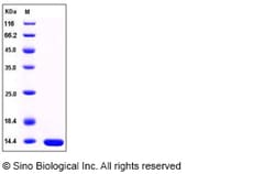 Sino Biological Human LAMTOR2 / ROBLD3 / MAPBPIP Protein (His Tag) 100ug,