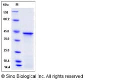 Sino Biological Recombinant Human HOXA1 Protein (His Tag), Quantity: Each